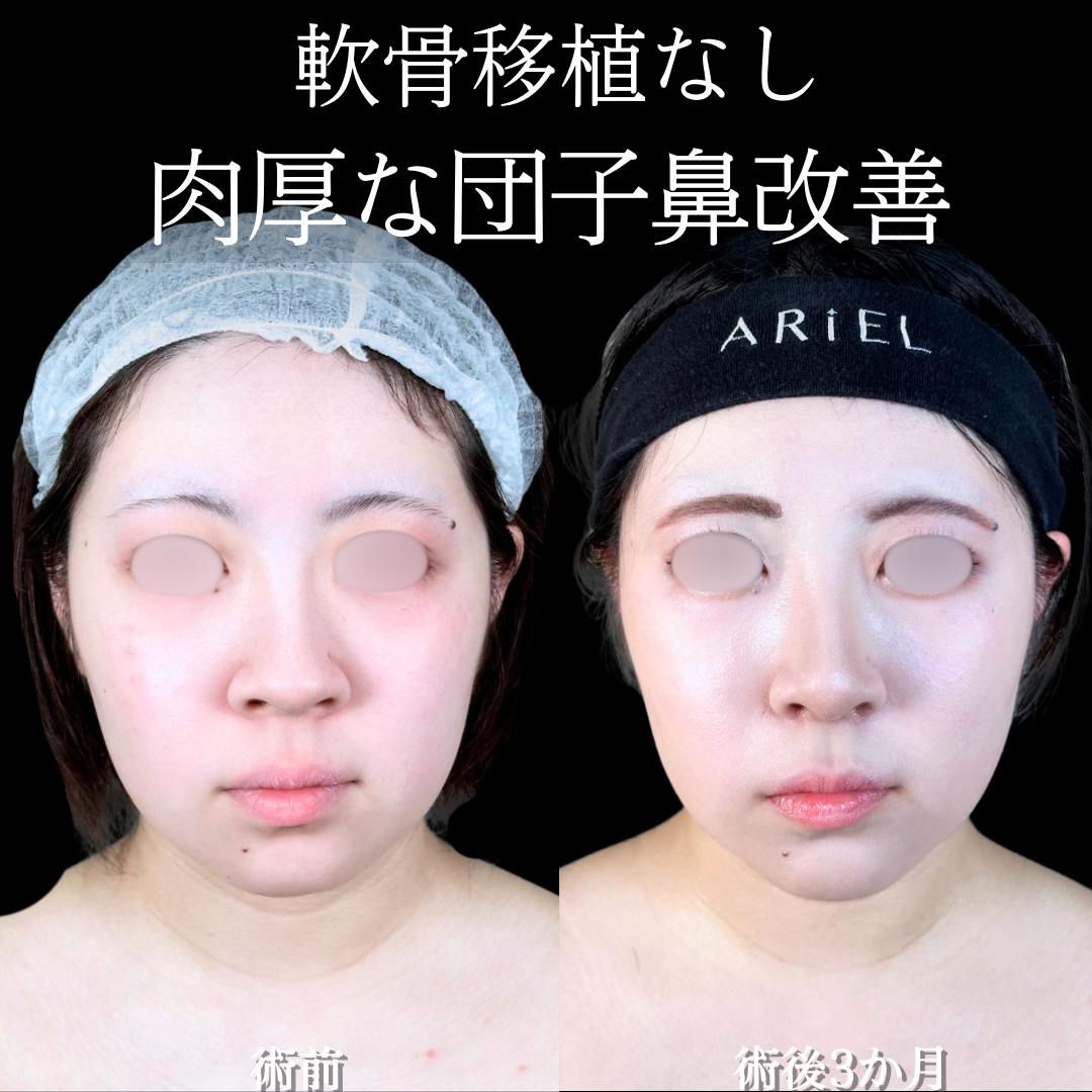 No.15601の症例写真 No.15601の症例写真