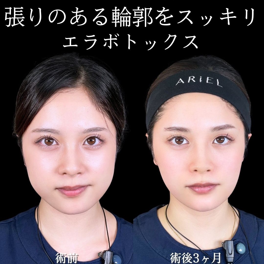 No.15588の症例写真 No.15588の症例写真