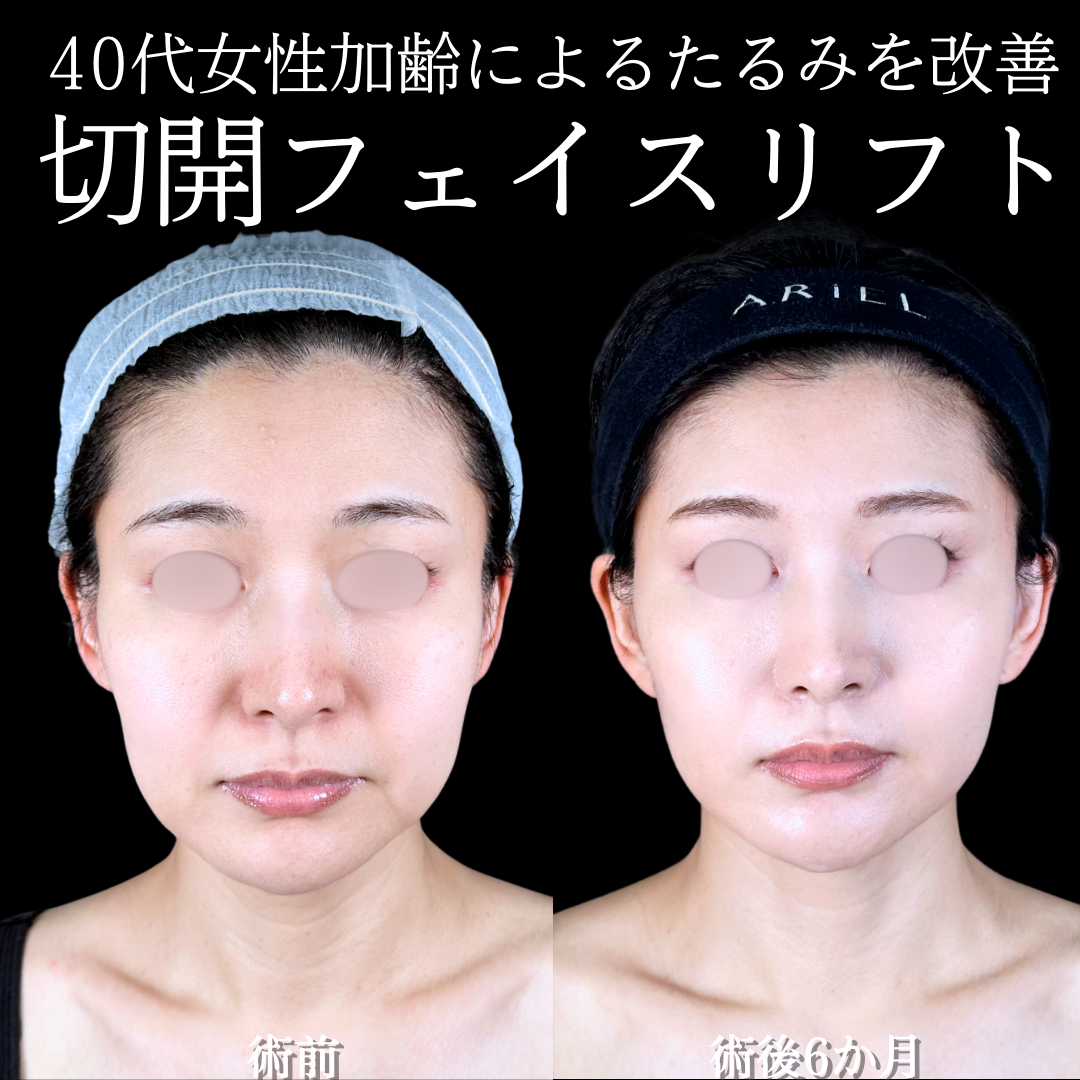 No.15638の症例写真 No.15638の症例写真