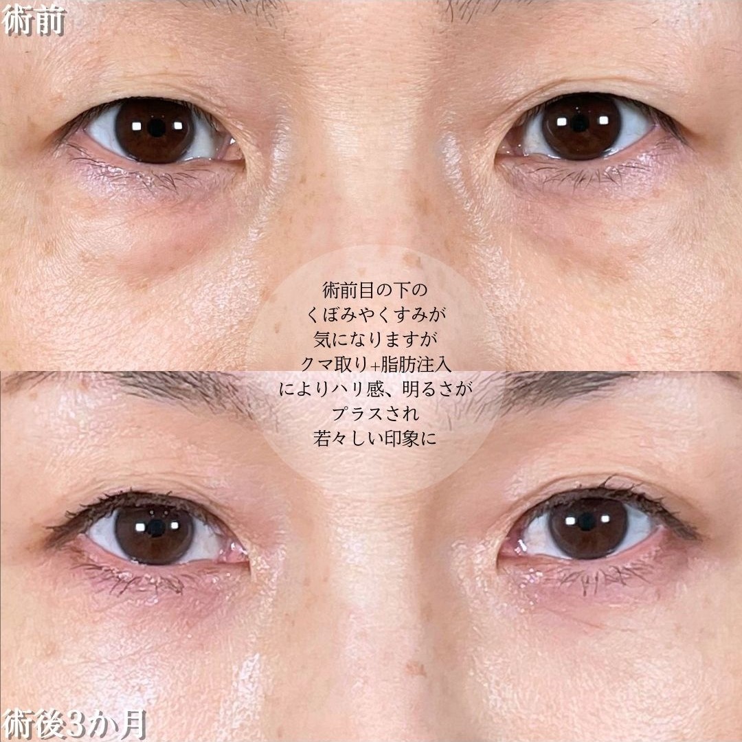 No.15536の症例写真1