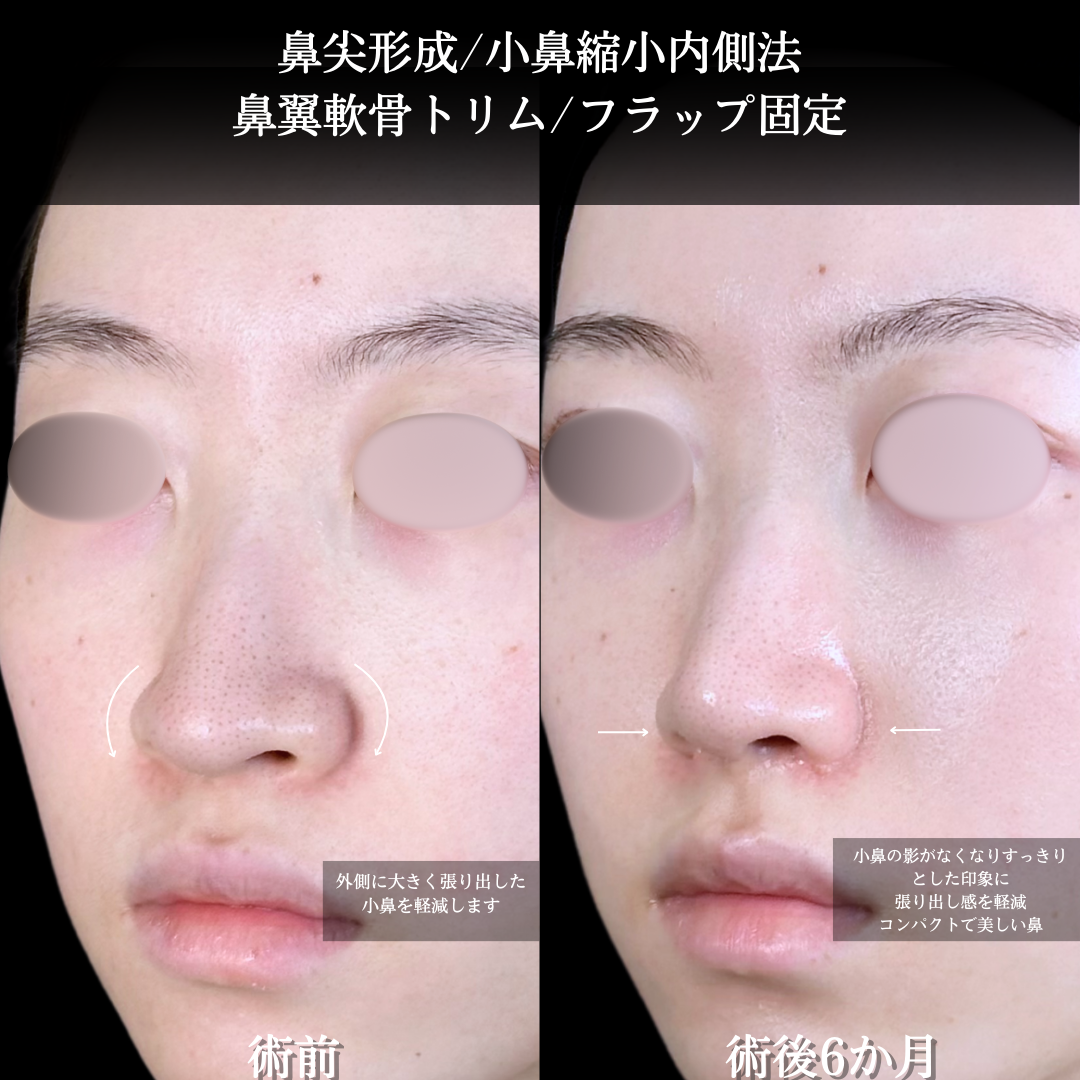 No.15532の症例写真1