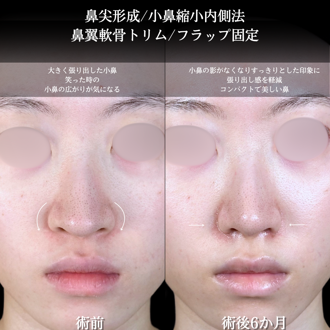 No.15548の症例写真2