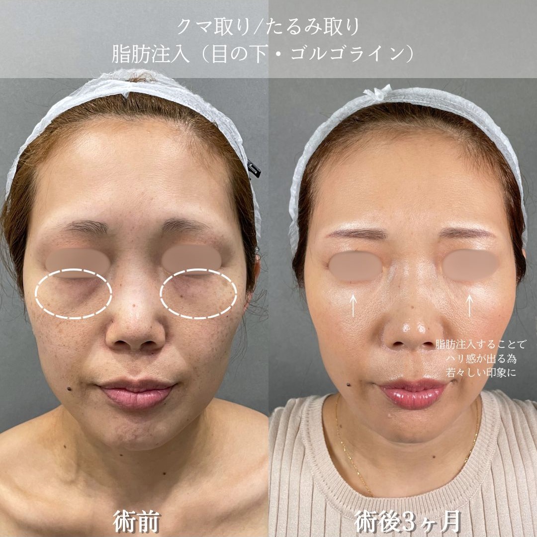 No.15562の症例写真1