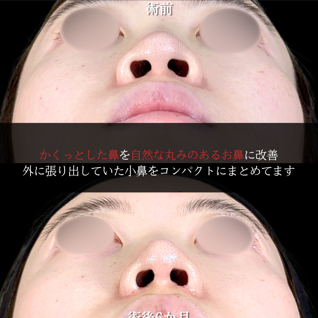 No.15565の症例写真1