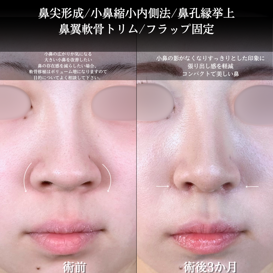 No.15601の症例写真1