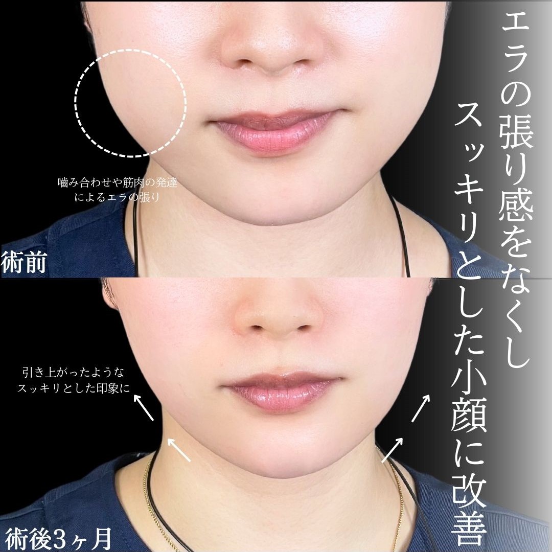 No.15588の症例写真1