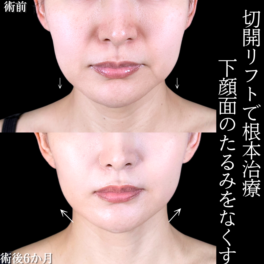 No.15638の症例写真1