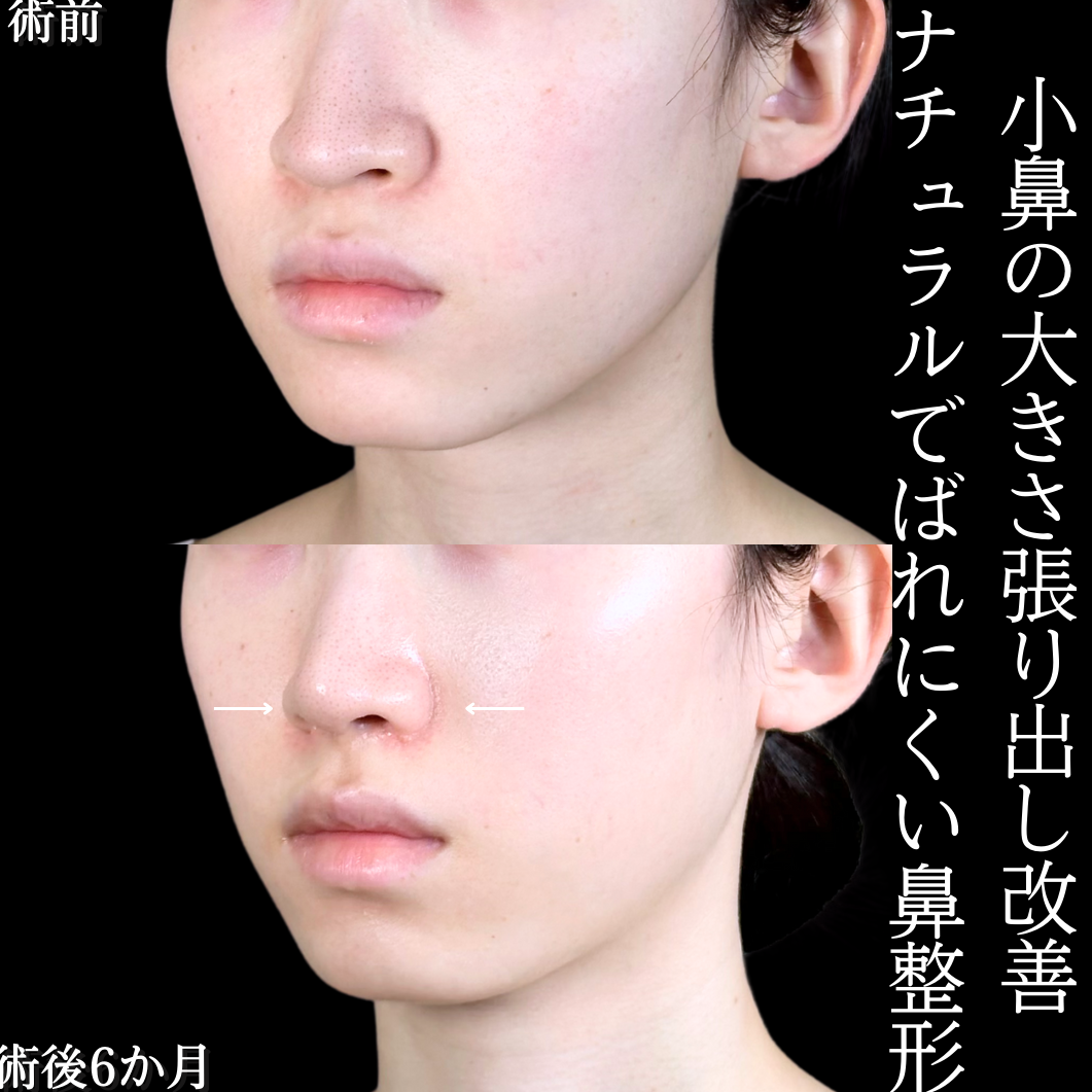 No.15532の症例写真2