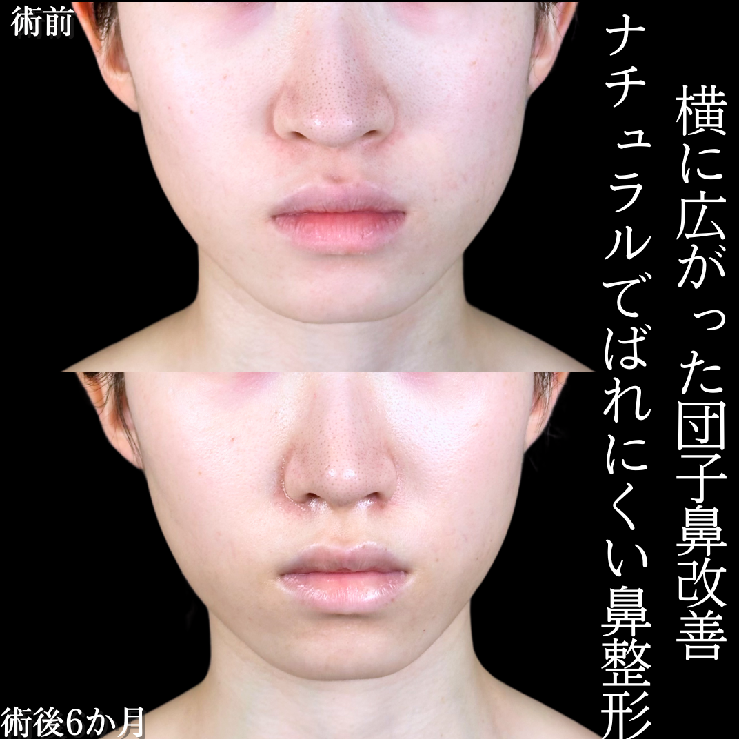 No.15548の症例写真1