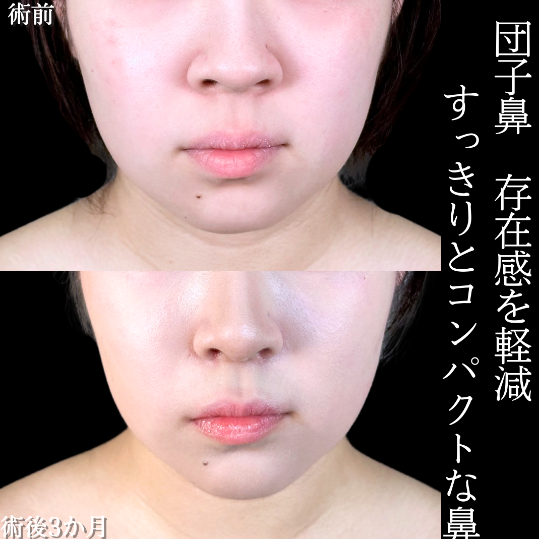 No.15601の症例写真2