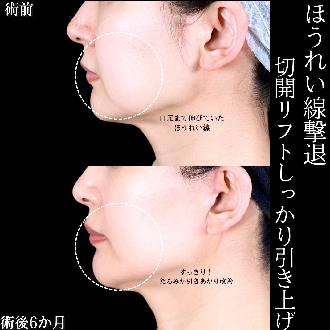No.15638の症例写真2