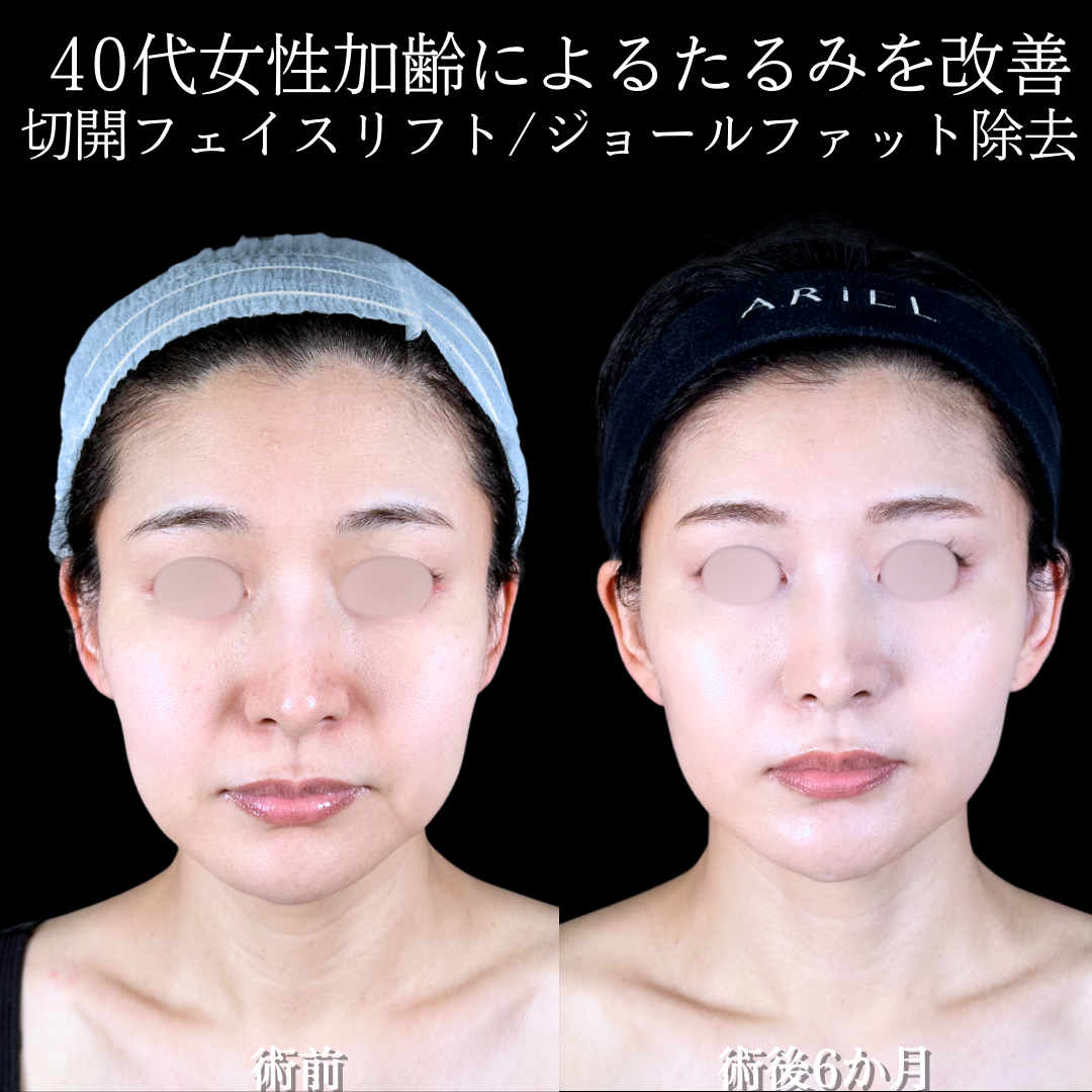 No.15638の症例写真3