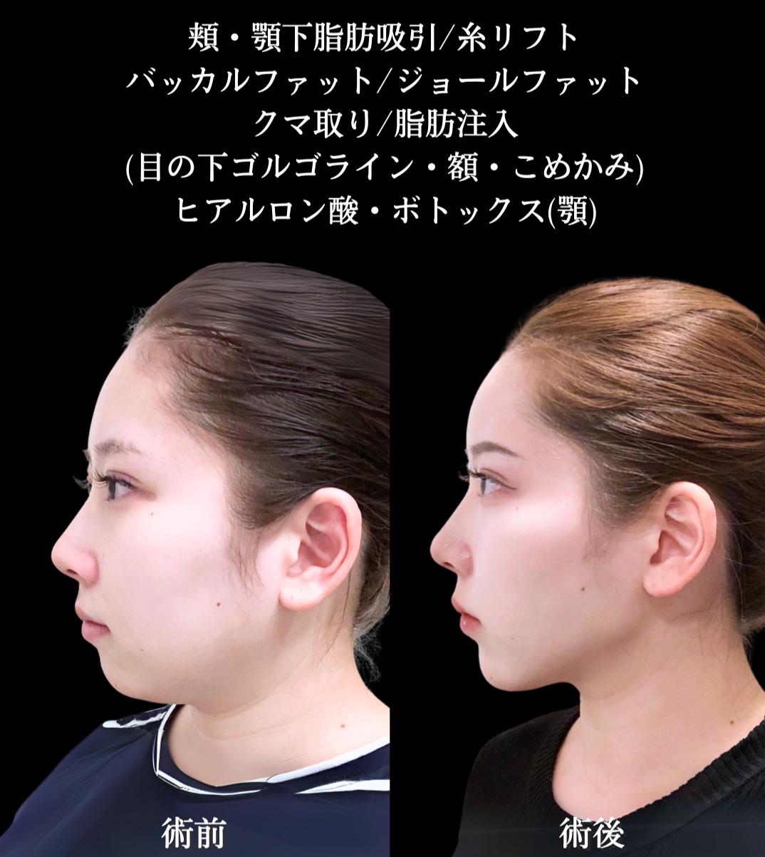 No.15608の症例写真3