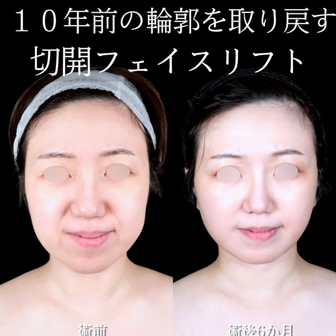 No.15647の症例写真 No.15647の症例写真