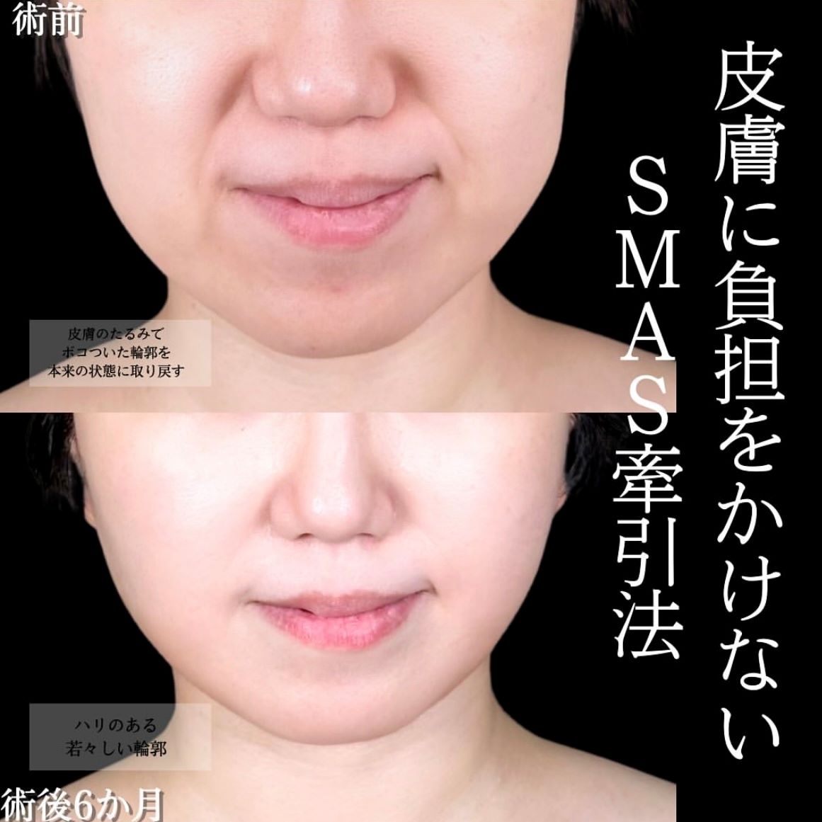 No.15647の症例写真1