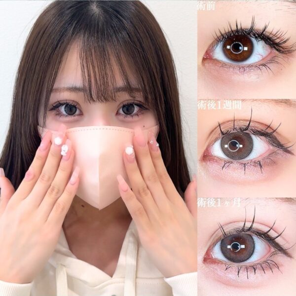 No.15756の症例写真