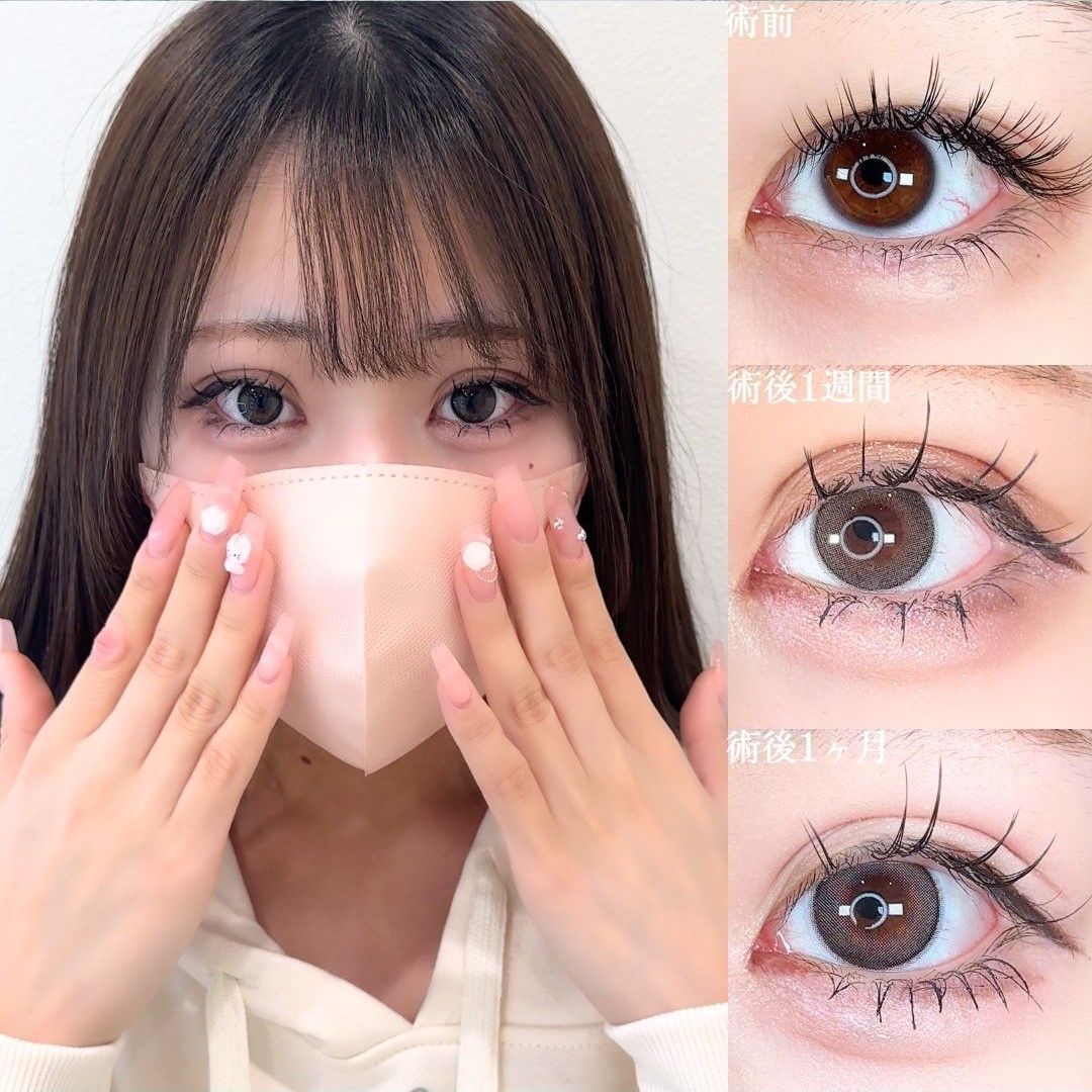 No.15756の症例写真 No.15756の症例写真