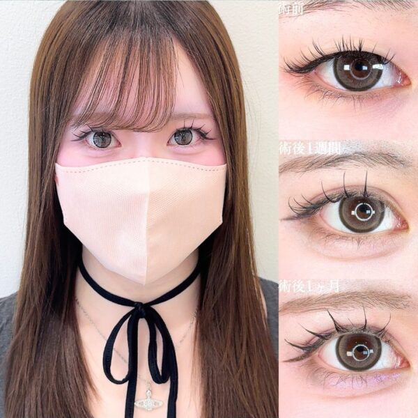 No.15828の症例写真