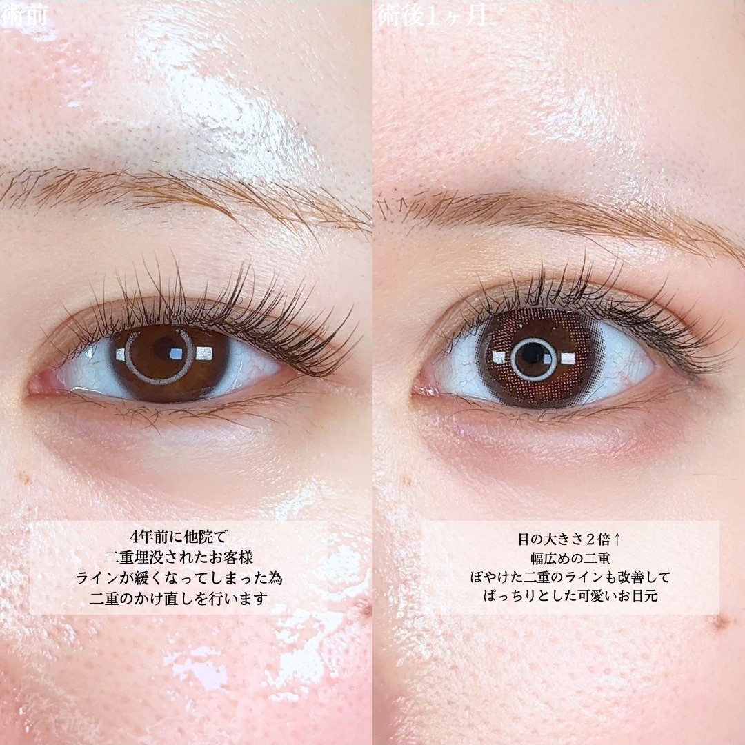 No.16039の症例写真1