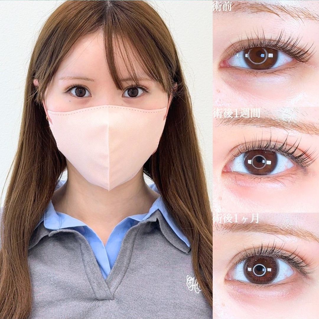 No.16039の症例写真 No.16039の症例写真