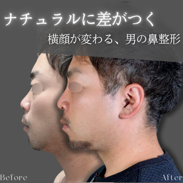 No.25247の症例写真