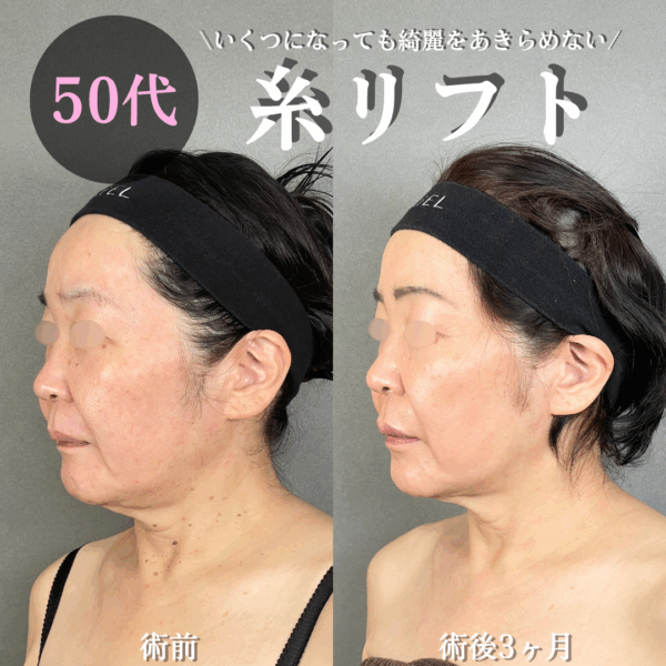 No.16421の症例写真