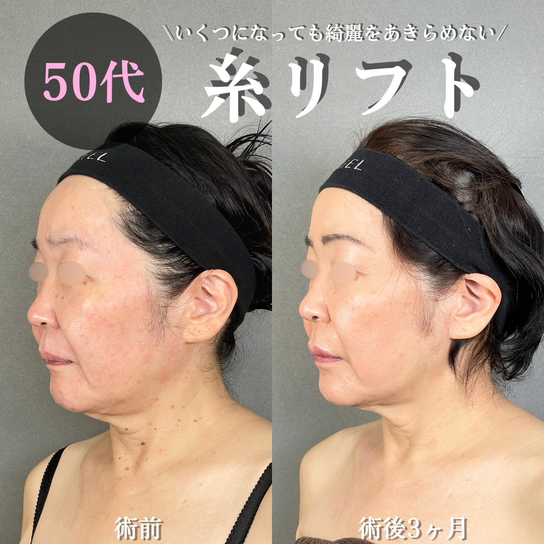 No.16421の症例写真 No.16421の症例写真