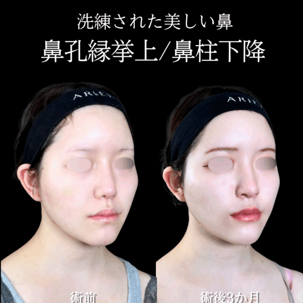 No.16499の症例写真