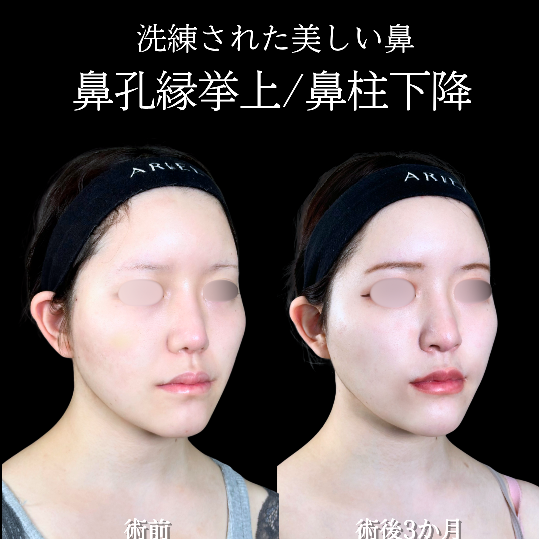 No.16499の症例写真 No.16499の症例写真