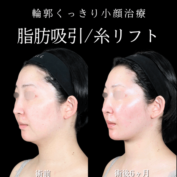 No.16414の症例写真