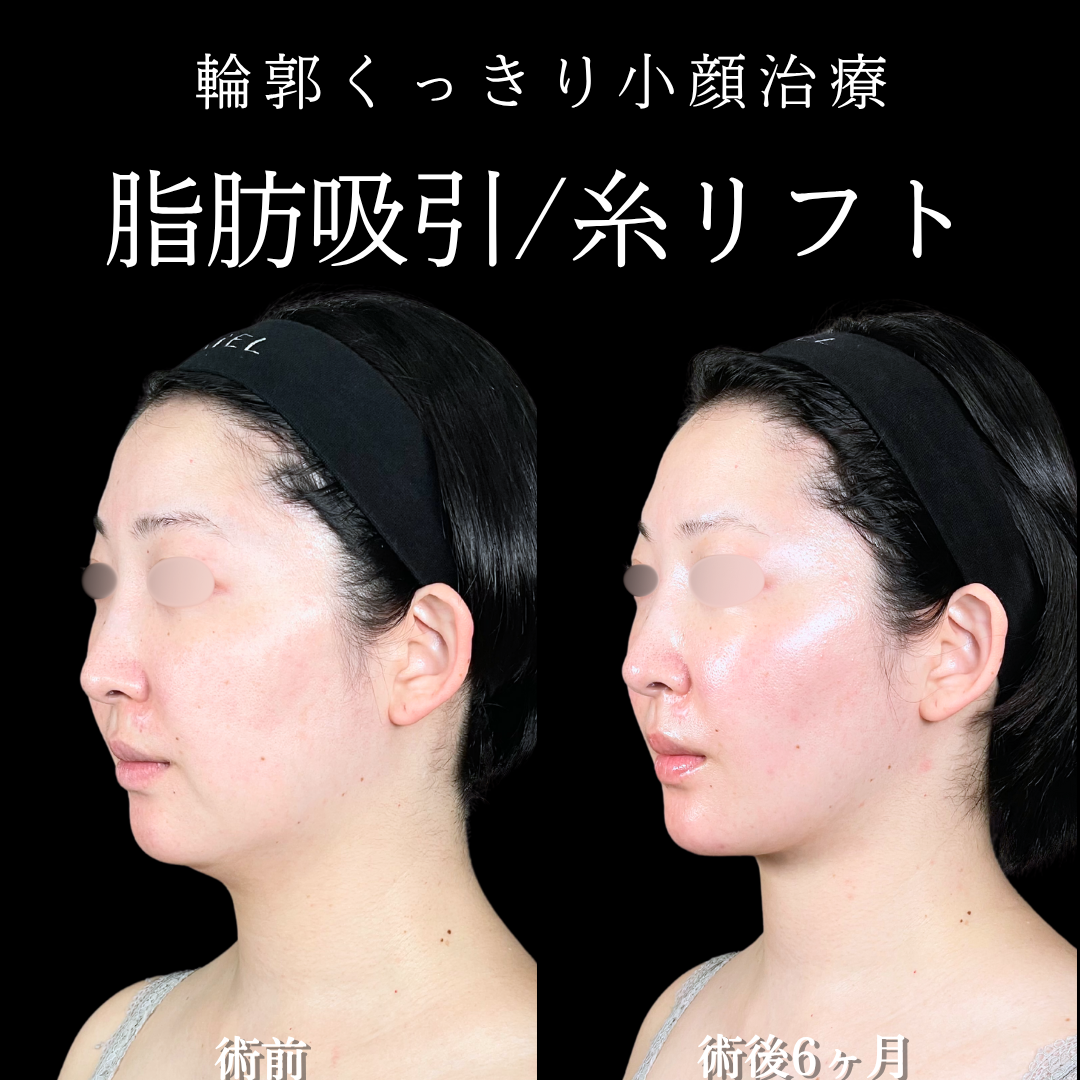 No.16414の症例写真 No.16414の症例写真