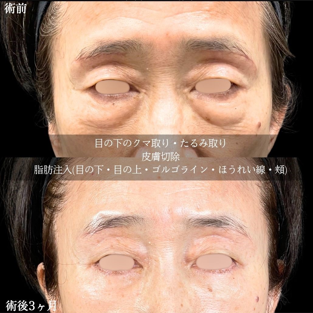 No.16461の症例写真2