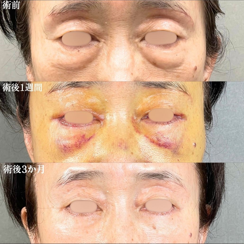 No.16461の症例写真1