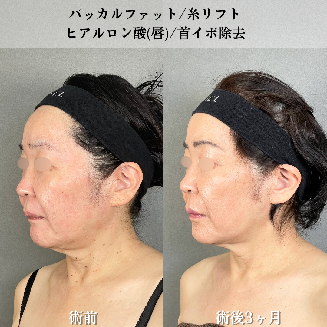 No.16421の症例写真3