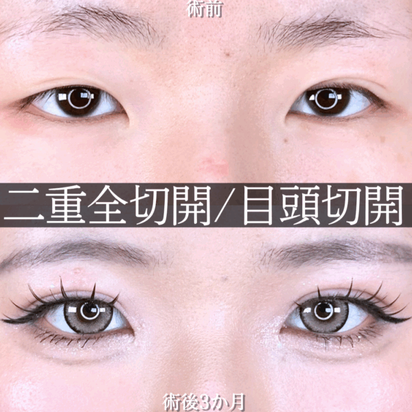 No.16512の症例写真