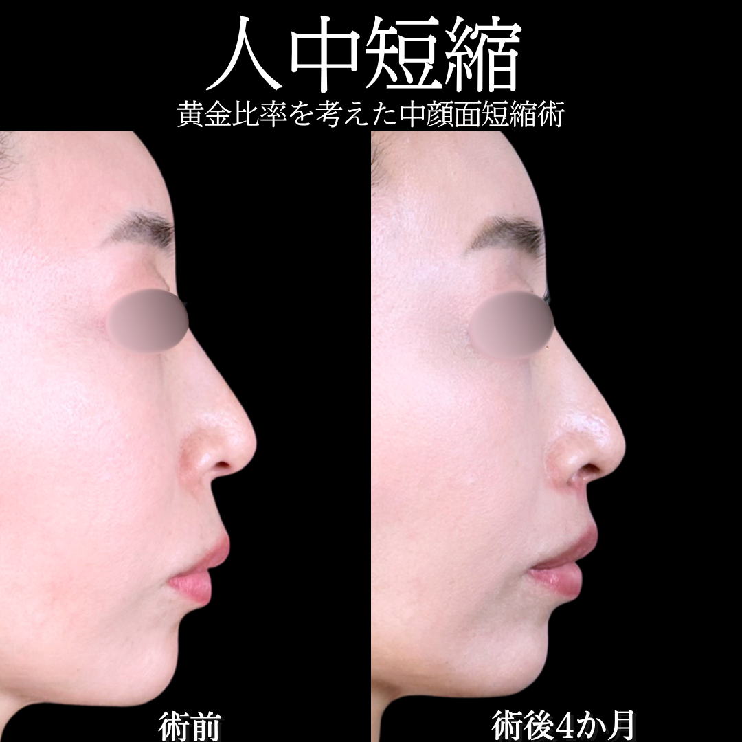 No.16528の症例写真 No.16528の症例写真