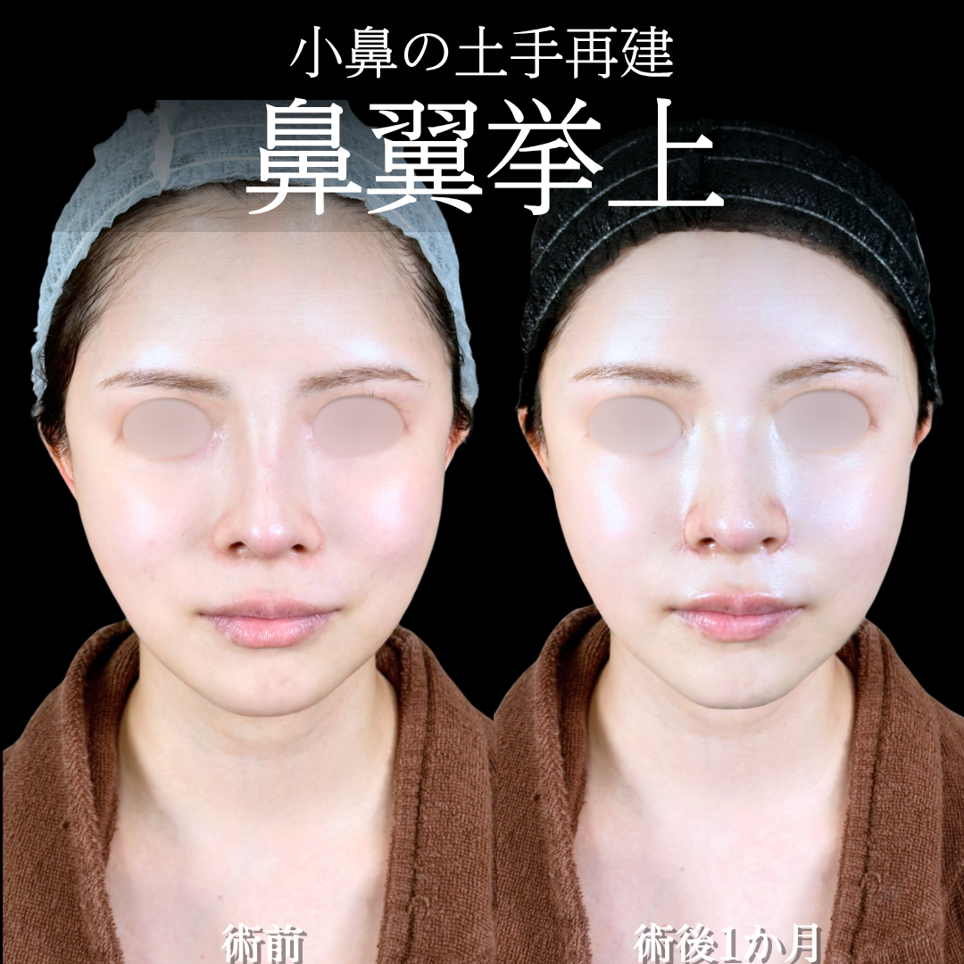 No.16522の症例写真 No.16522の症例写真