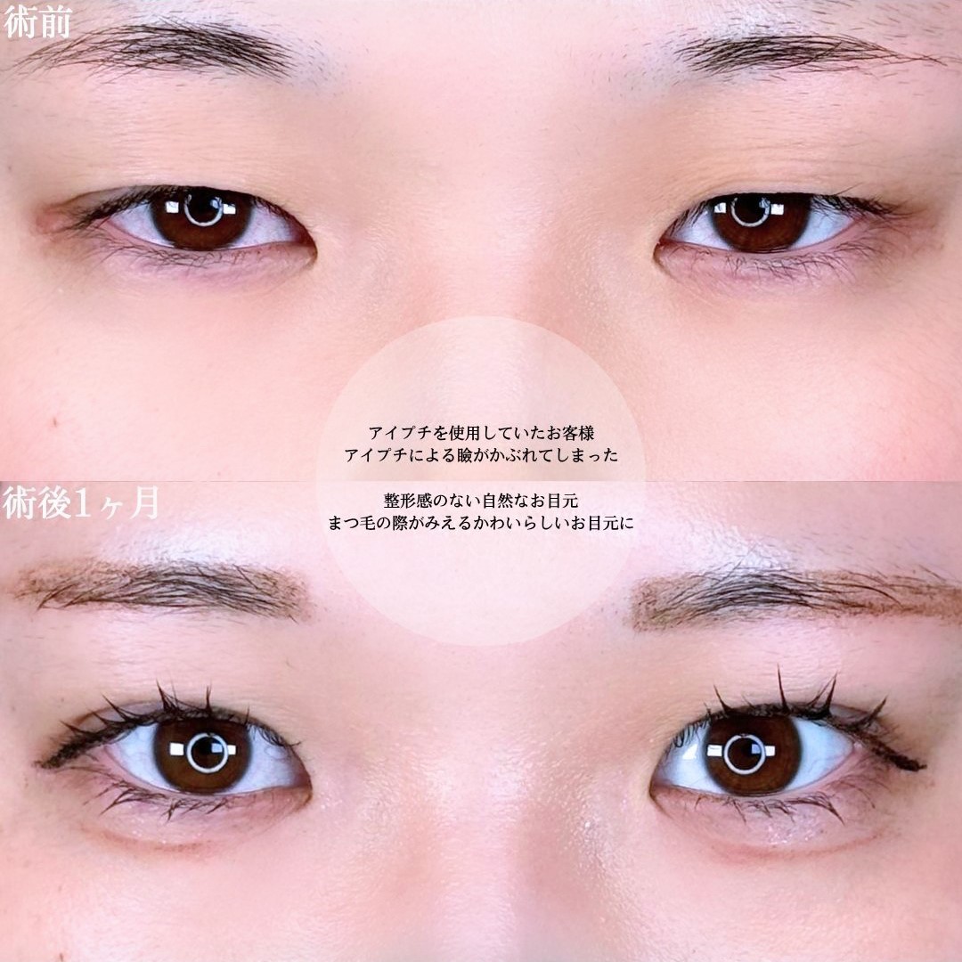 No.16563の症例写真1