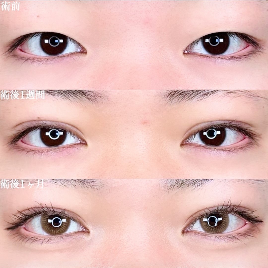 No.16431の症例写真