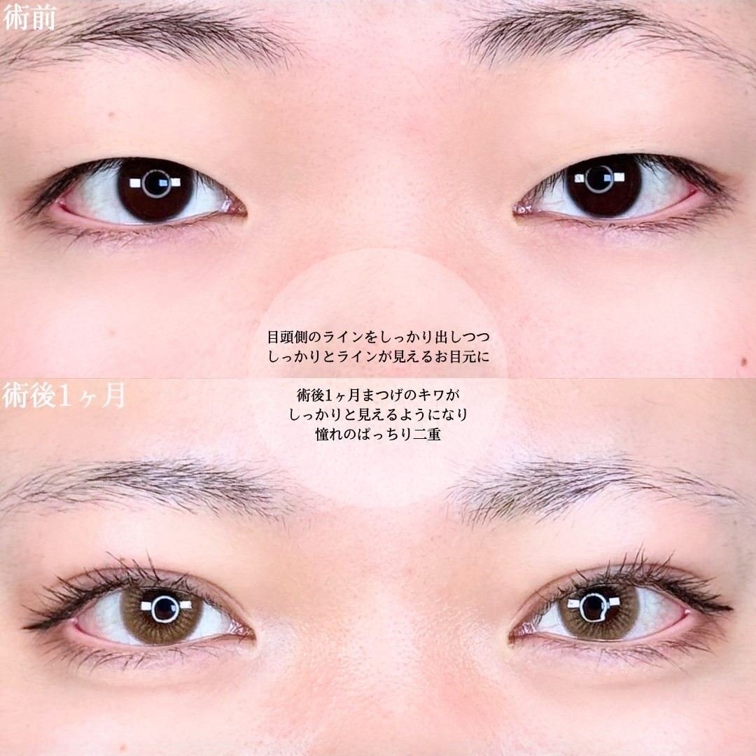 No.16431の症例写真1