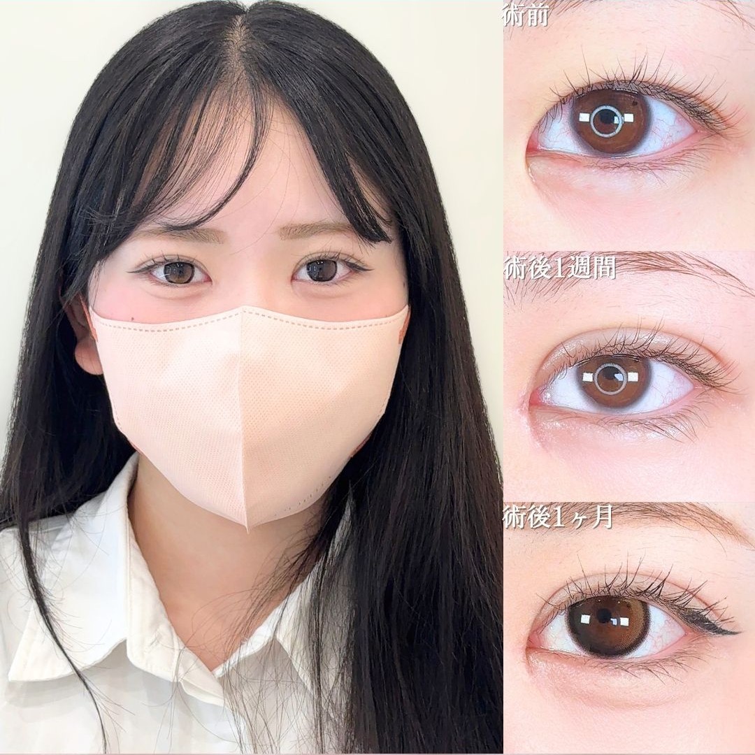 No.16440の症例写真