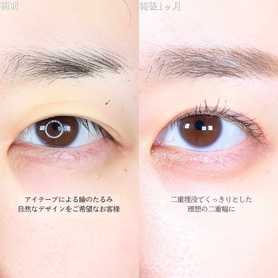No.16493の症例写真1