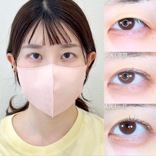 No.16493の症例写真