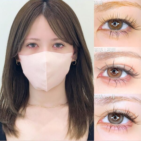 No.16241の症例写真