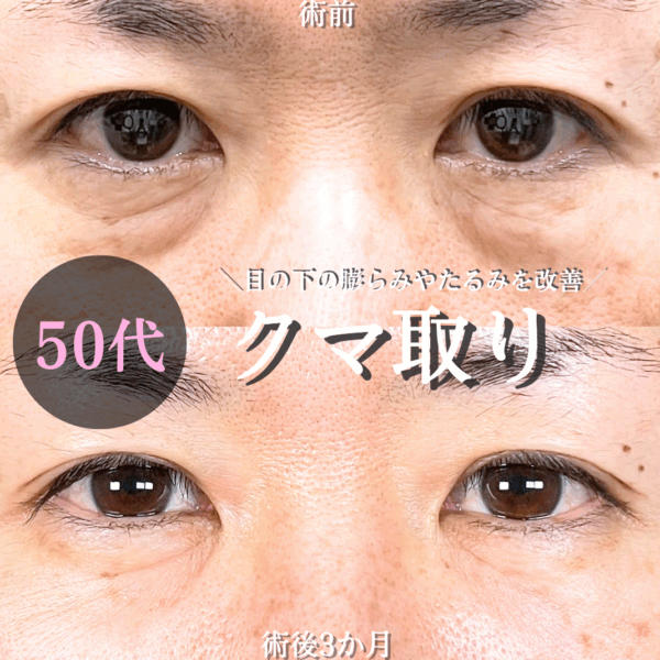 No.16754の症例写真