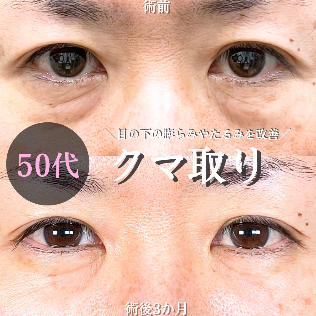 No.16754の症例写真 No.16754の症例写真