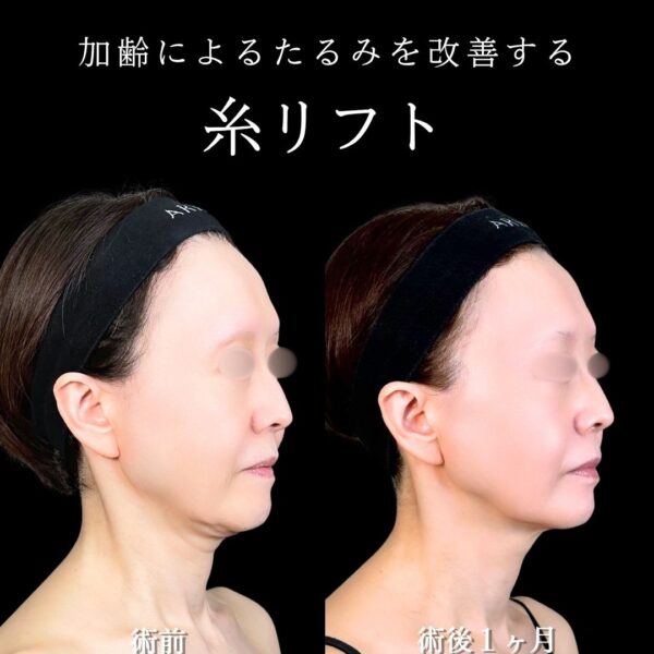 No.16698の症例写真