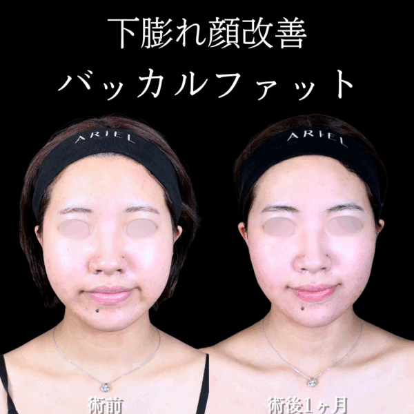 No.16763の症例写真
