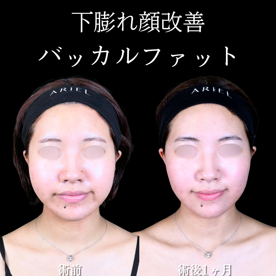 No.16763の症例写真 No.16763の症例写真