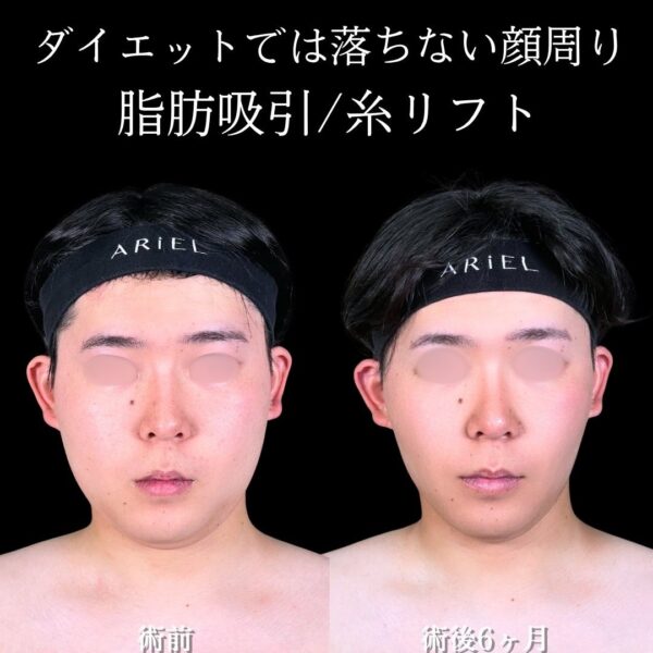 No.16705の症例写真